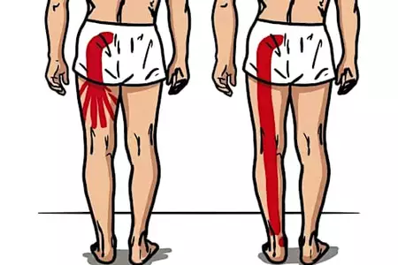 Burning feet ruined my nights—then I found this