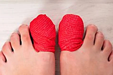 Do This if You Have Toenail Fungus (Try Tonight)