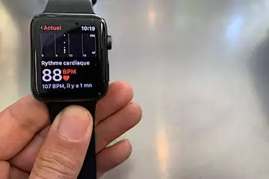 Este reloj conectado sorprende a todo el país.  ¿Su precio?  ¡Solo 79 €!