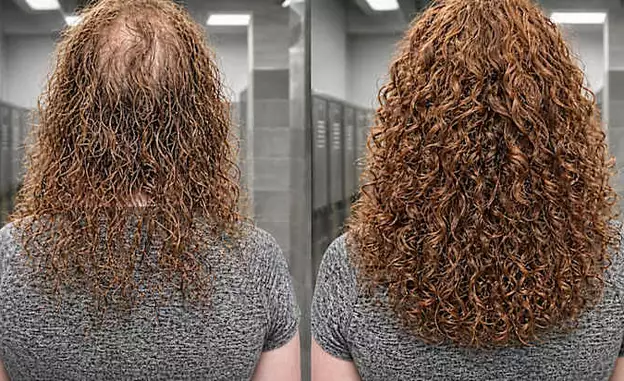 The Simple Household Trick More Women Over 60 Are Using on Thinning Hair The Simple Household Trick More Women Over 60 Are Using on Thinning Hair