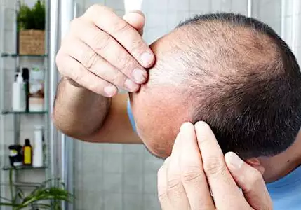 Truque indígena para crescer cabelo nas entradas vira febre no Brasil
