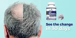 Forget Hair Surgery! Don't Waste Your Money Do This Instead!