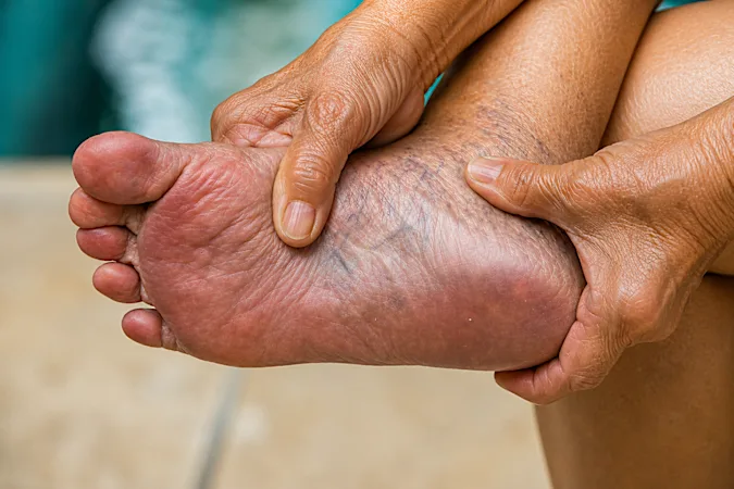 Neuropathy? When Burning, Tingling & Numbness Won't Stop, Try This