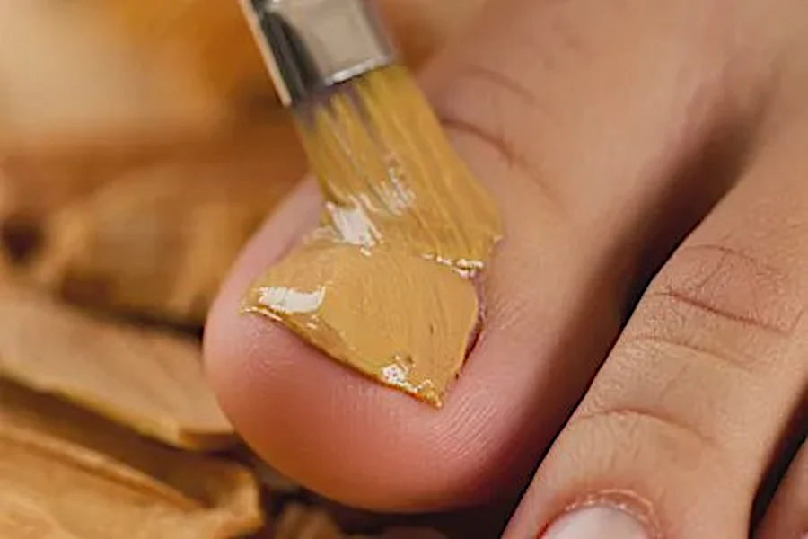 Médecin: Voici l’astuce simple de 2026 contre la mycose de l’ongle (c’est génial)
