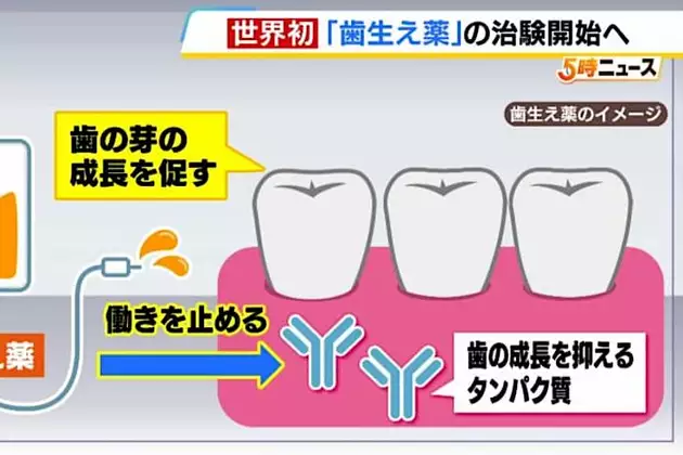 世界初『歯を生やす薬』今年９月に治験開始「先天性無歯症」の治療に　将来的には虫歯で歯を失った人の治療にも「歯医者の夢ですよね」