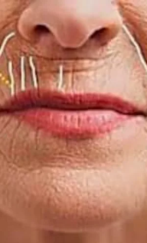Un expert supplie aux françaises de "combler" leurs rides avec cette astuce (c'est génial)