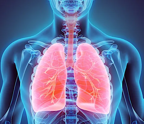 Tratamientos para Cáncer de pulmón que podrían ser eficaces Tratamientos para Cáncer de pulmón que podrían ser eficaces