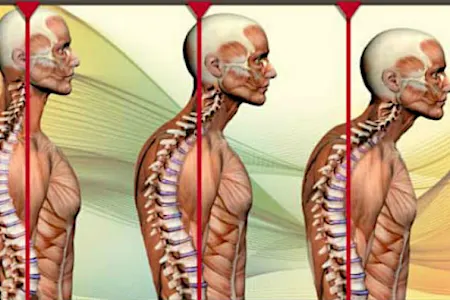 Correggere la postura: ecco un rimedio pratico e veloce Correggere la postura: ecco un rimedio pratico e veloce