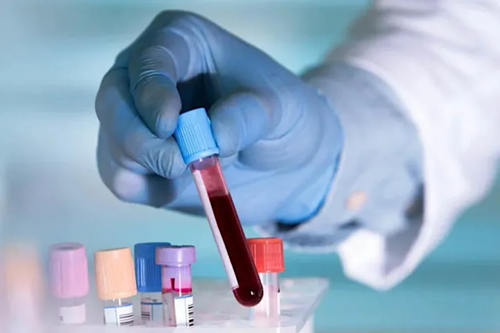 যে রক্তের গ্রুপে করোনা ঝুঁকি বেশি, জানলেন চীনের গবেষক দল যে রক্তের গ্রুপে করোনা ঝুঁকি বেশি, জানলেন চীনের গবেষক দল