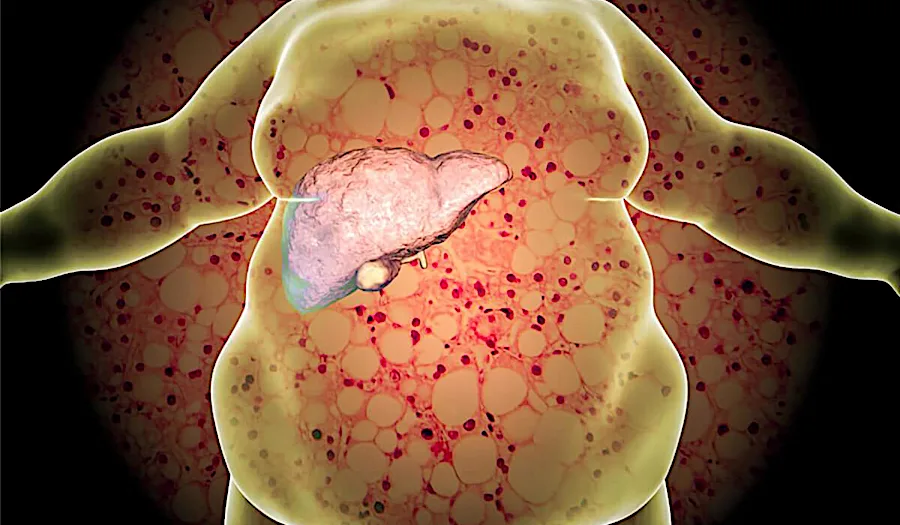 Nutricionista revela como queimar gordura abdominal