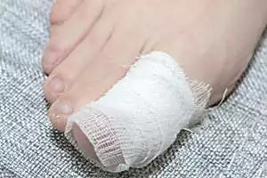 If You Have Toenail Fungus Try This Tonight (It's Genius!)