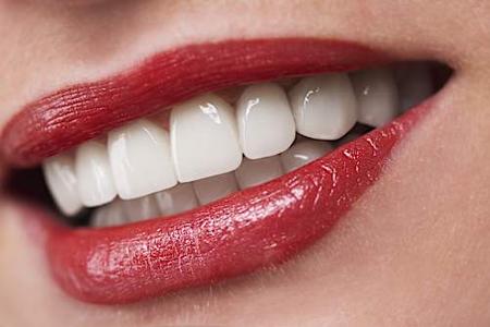 Need Dental Implants But Have No Money?