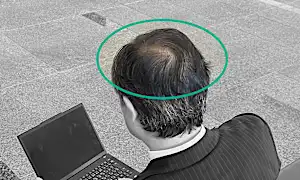 「頭頂部が薄くなってきたら」バスクリンが快挙！有効成分生薬100%の育毛剤を開発