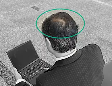 「頭皮が透けて見えたら…」バスクリンが快挙！有効成分生薬100%の育毛剤を開発
