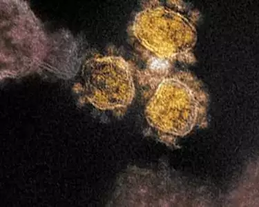 Descubren una forma de transmisión del coronavirus hasta ahora desconocida