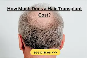 Colts Neck: Hair Transplant may be cheaper than you think! Check the Results