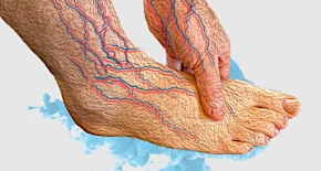 Do You Take B12 To Fight Neuropathy? Try This Instead