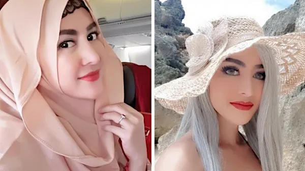 Tak Kuat Hijrah dan Lepas Hijab Lagi, Cynthiara Alona Pamerkan Wajahnya yang Bonyok Sambil Tertawa - iDEA.Grid.ID