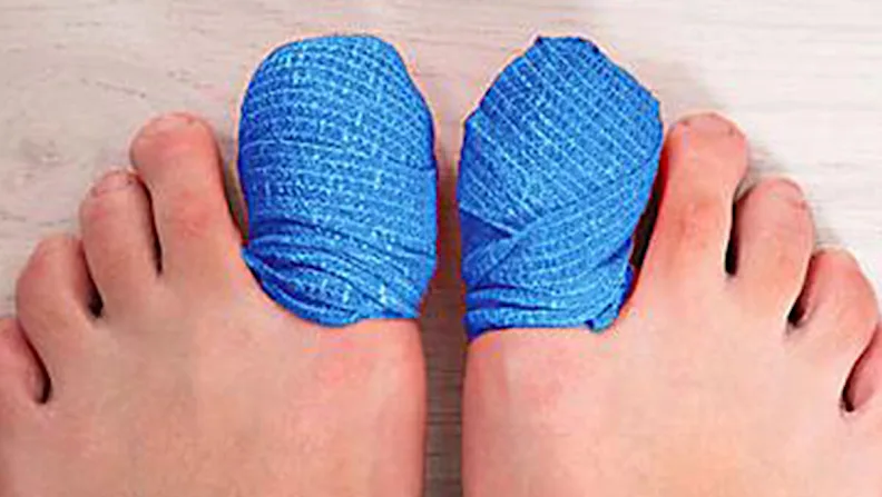 If You Have Toenail Fungus Try This Tonight (It's Genius!)
