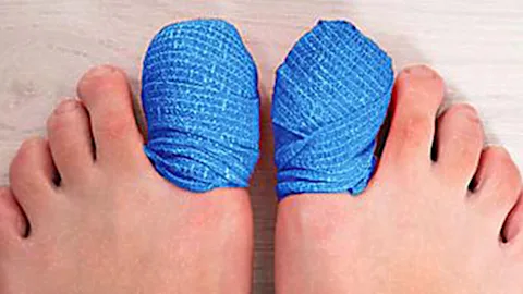 If You Have Toenail Fungus Try This Tonight (It's Genius!)
