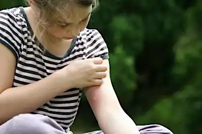 Are Mosquitoes Attracted to Some People More Than Others?