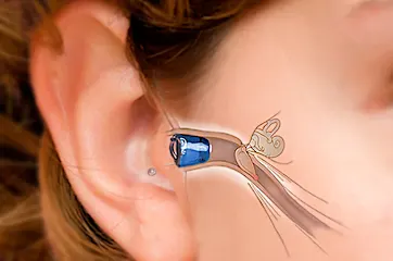 2021's Prices Of Hearing Aids Might Surprise You!