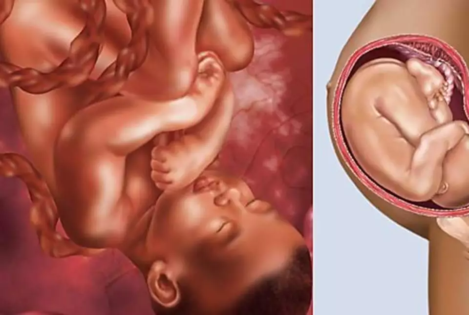 36 недель беременности кровь. Ребёнок на 38 неделе беременности.
