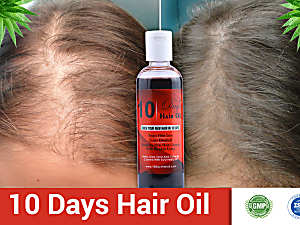 Losing Your Hair? Try This Incredible '10 Days' Hair Oil to Regrow