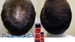 Handmade Oil in Kerala to prevent and treat excessive hair loss Handmade Oil in Kerala to prevent and treat excessive hair loss