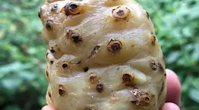 Glaucoma and cataract can disappear! And vision can return quickly (Stop Doing This)