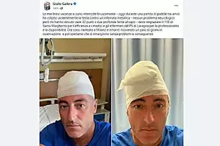 Gallera, incidente in vacanza: 30 punti di sutura alla testa | Virgilio Notizie