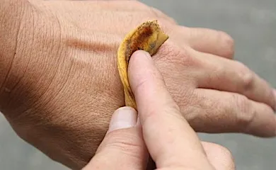 She puts a banana peel on her arm and look what happens next!