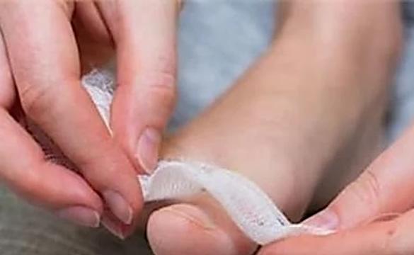 Simple Way To Reduce Toenail Fungus? (Watch)