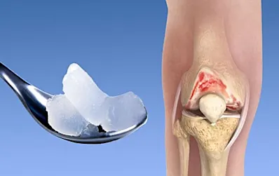 If You Suffer From Knee and Hip Pain You Should Read This