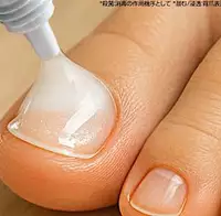 250万本突破「スッと浸透して殺菌」しぶとい爪菌を一掃する薬用ジェル
