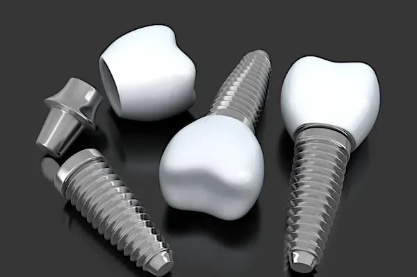 See What Full Mouth Dental Implants May Cost You.