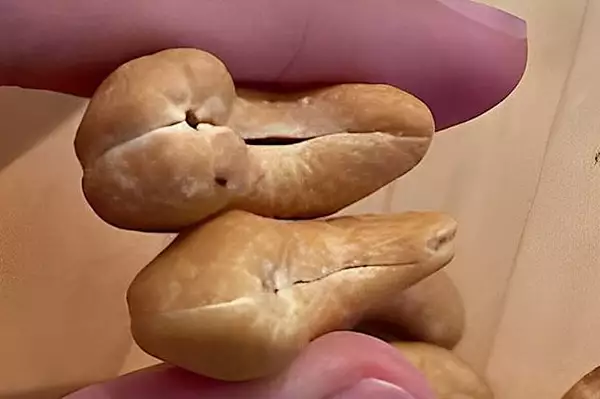 Τα άτομα με υψηλά επίπεδα σακχάρου στο αίμα πρέπει να το γνωρίζουν αυτό