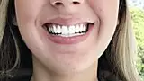 Novo clareador dental caseiro choca o Brasil