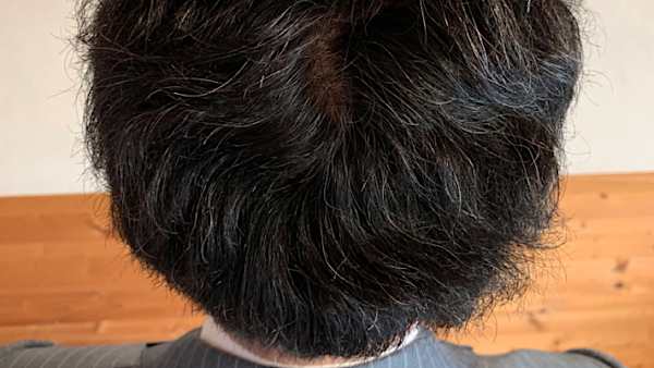 「モンド最高金賞」この育毛剤、芸能界の愛用者が絶えない！