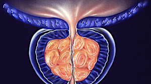 Prostate gonflée : "Pratiquez chaque jour ce rituel de 30 secondes pour réduire sa taille"