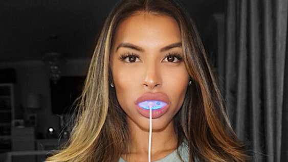 Worlds #1 Teeth Whitening System Now Available to Public