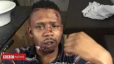 Good Samaritan TV host 'beaten by racists'