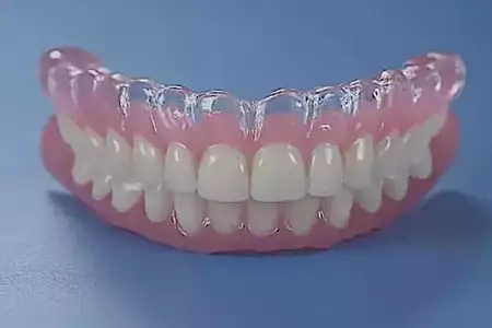 Che cosa sono gli impianti dentali senza viti e quanto costano a Rabat? Che cosa sono gli impianti dentali senza viti e quanto costano a Rabat?