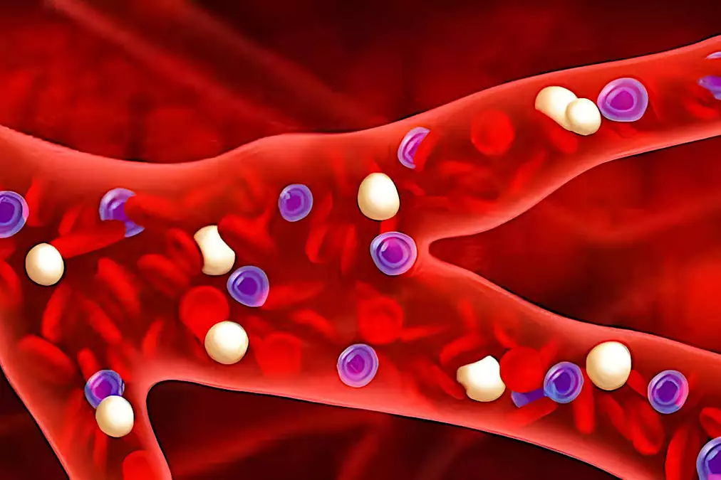 Cholesterin: Wenige kennen diese Lösung