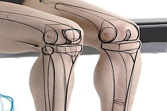 Los que sufren de dolor de rodilla y cadera deberían leer esto Los que sufren de dolor de rodilla y cadera deberían leer esto