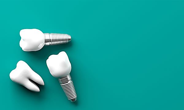 Here’s what dental implants could cost in 2020