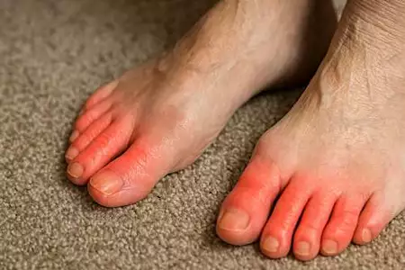 Diabetes and Numb Feet? Put These In Your Shoes! Diabetes and Numb Feet? Put These In Your Shoes!