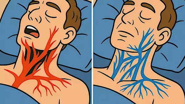 睡眠呼吸暂停毁了我的生活——后来我发现了这个简单的技巧