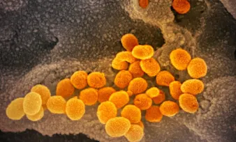 Live updates: The latest on the coronavirus pandemic