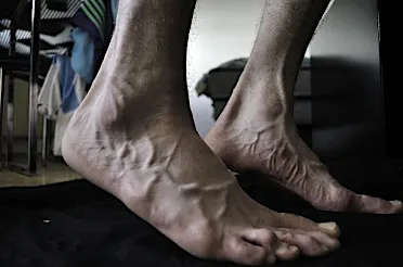 Neuropathy (Nerve Pain)? Do This Immediately (Watch)